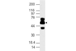 Image no. 1 for anti-ATG16 Autophagy Related 16-Like 1 (ATG16L1) (AA 35-260) antibody (ABIN5027030) (ATG16L1 Antikörper  (AA 35-260))