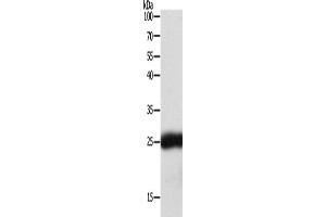 Western Blotting (WB) image for anti-Synaptosomal-Associated Protein, 25kDa (SNAP25) antibody (ABIN2428724) (SNAP25 Antikörper)