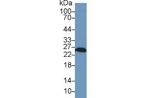 Western Blot; Sample: Human A549 cell lysate; Primary Ab: 1µg/ml Rabbit Anti-Rat UCHL1 Antibody Second Ab: 0. (UCHL1 Antikörper  (AA 2-223))