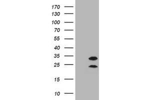 Image no. 3 for anti-Membrane-Spanning 4-Domains, Subfamily A, Member 1 (MS4A1) antibody (ABIN1497206) (CD20 Antikörper)