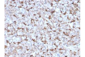 Formalin-fixed, paraffin-embedded human Pituitary stained with Prolactin Mouse Monoclonal Antibody (PRL/2643). (Prolactin Antikörper  (AA 63-201))