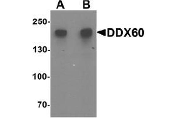 DDX60 Antikörper  (Middle Region)