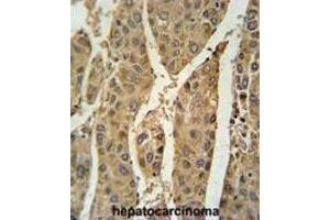 Immunohistochemistry (IHC) image for anti-Peroxiredoxin 6 (PRDX6) antibody (ABIN3001724) (Peroxiredoxin 6 Antikörper)