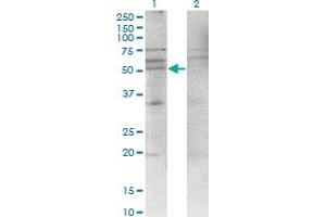 Western Blotting (WB) image for anti-Chemokine (C-X-C Motif) Receptor 4 (CXCR4) (AA 1-46) antibody (ABIN521674)