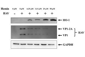 Changes in HO-1 and HAV proteins according to hemin concentration. (HAV VP1 Antikörper)