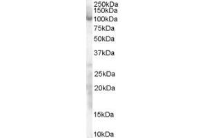 Western Blotting (WB) image for anti-Sp1 Transcription Factor (SP1) (AA 68-82) antibody (ABIN291116) (SP1 Antikörper  (AA 68-82))