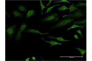 Immunofluorescence of monoclonal antibody to FOXO1 on HeLa cell. (FOXO1 Antikörper  (AA 452-555))