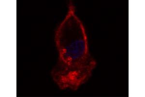 Hooded seal bronchoalveolar lavage cells were stained with Mouse Anti-Human CD14-UNLB:. (CD14 Antikörper)