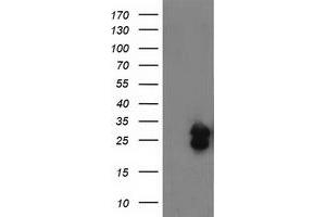 HEK293T cells were transfected with the pCMV6-ENTRY control (Left lane) or pCMV6-ENTRY FGF21 (Right lane) cDNA for 48 hrs and lysed. (FGF21 Antikörper  (AA 29-209))