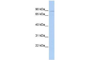 WB Suggested Anti-MEFV Antibody Titration:  0. (MEFV Antikörper  (N-Term))