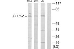 Western Blotting (WB) image for anti-Glycerol Kinase 2 (GK2) (AA 281-330) antibody (ABIN2889591) (GK2 Antikörper  (AA 281-330))