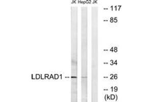 Western blot analysis of extracts from Jurkat/HepG2 cells, using LDLRAD1 Antibody. (LDLRAD1 Antikörper  (AA 84-133))