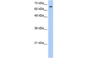 SYVN1 antibody used at 1. (SYVN1 Antikörper  (Middle Region))