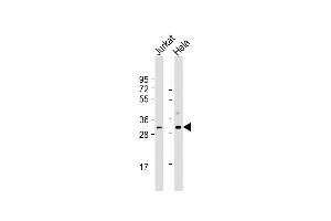 All lanes : Anti-CDK1 Antibody at 1:500-1:1000 dilution Lane 1: Jurkat whole cell lysate Lane 2: Hela whole cell lysate Lysates/proteins at 20 μg per lane. (CDK1 Antikörper  (AA 1-297))