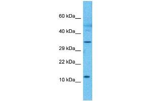 Western Blotting (WB) image for anti-RP3-473B4.1 (N-Term) antibody (ABIN2785035) (RP3-473B4.1 (N-Term) Antikörper)