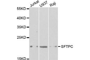 Western blot analysis of extracts of various cell lines, using SFTPC antibody. (Surfactant Protein C Antikörper  (AA 1-197))