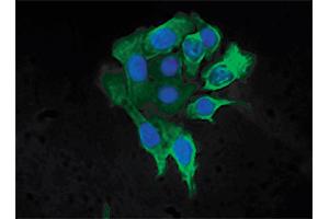 Human pancreatic carcinoma cell line MIA PaCa-2 was stained with Mouse Anti-Cytokeratin 8-FITC followed by DAPI. (KRT8 Antikörper  (C-Term) (FITC))