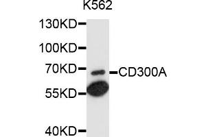 Western blot analysis of extracts of K-562 cells, using CD300A antibody (ABIN6003714) at 1/1000 dilution. (CD300a Antikörper)