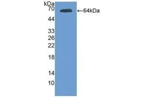 Detection of Recombinant Tie2, Mouse using Polyclonal Antibody to TEK Tyrosine Kinase, Endothelial (Tie2) (TEK Antikörper)