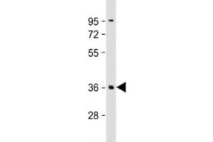 Western blot testing of human brain lysate with PLK5 antibody at 1:2000. (PLK5 Antikörper  (AA 140-174))