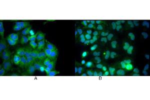 Immunofluorescence (IF) image for anti-Nuclear Factor-kB p65 (NFkBP65) (C-Term) antibody (ABIN964680)