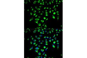 Immunofluorescence analysis of MCF-7 cells using CD86 antibody (ABIN5970542). (CD86 Antikörper)