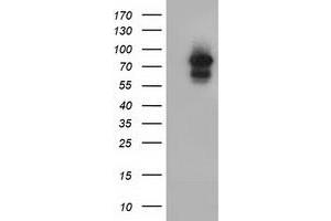 Western Blotting (WB) image for anti-Aryl Hydrocarbon Receptor Nuclear Translocator (ARNT) antibody (ABIN1496730) (ARNT Antikörper)