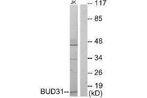 Western blot analysis of extracts from Jurkat cells, using BUD31 antibody. (BUD31 Antikörper  (Internal Region))