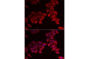 Immunofluorescence analysis of HeLa cells using SFRP4 antibody (ABIN5973810). (SFRP4 Antikörper)