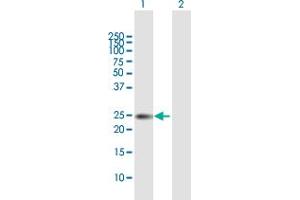 Western Blot analysis of TIMP1 expression in transfected 293T cell line by TIMP1 MaxPab polyclonal antibody. (TIMP1 Antikörper  (AA 1-207))