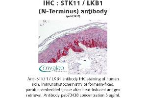 Image no. 1 for anti-serine/threonine Kinase 11 (STK11) antibody (ABIN1739721) (LKB1 Antikörper)