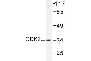 Image no. 1 for anti-Cyclin-Dependent Kinase 2 (CDK2) antibody (ABIN265344) (CDK2 Antikörper)