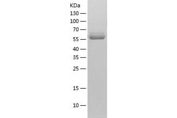 PKM2 Protein (AA 1-531) (His tag)