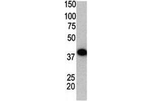 Western blot using SUMO2 antibody and GST-SUMO2 fusion protein. (SUMO2 Antikörper  (AA 63-93))