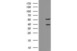 Western Blotting (WB) image for anti-Ras Association (RalGDS/AF-6) Domain Family Member 1 (RASSF1) (AA 1-341) antibody (ABIN1490755) (RASSF1 Antikörper  (AA 1-341))