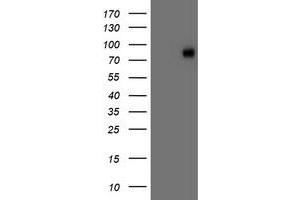 Western Blotting (WB) image for anti-Vascular Cell Adhesion Molecule 1 (VCAM1) antibody (ABIN1497156) (VCAM1 Antikörper)