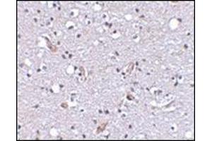 Immunohistochemical staining of human brain tissue using AP30591PU-N at 2. (SLC9A1 Antikörper  (C-Term, N-Term))
