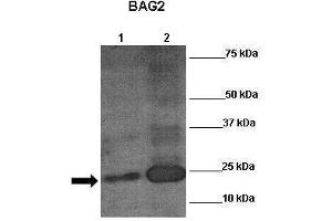 Sample Type: Lane 1:241 µg mouse mesenchymal stem cell lysate Primary Antibody Dilution: 1:0000Secondary Antibody: Anti-rabbit-HRP Secondary Antibody Dilution: 1:00,000 Color/Signal Descriptions: RUNX2  Gene Name: Anonymous Submitted by: (RUNX2 Antikörper  (N-Term))