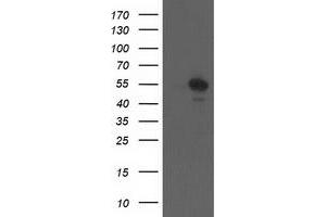 Western Blotting (WB) image for anti-Cerebral Cavernous Malformation 2 (CCM2) antibody (ABIN1497135) (CCM2 Antikörper)