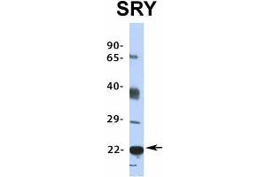 Host:  Rabbit  Target Name:  SRY  Sample Type:  HepG2  Antibody Dilution:  1. (SRY Antikörper  (Middle Region))