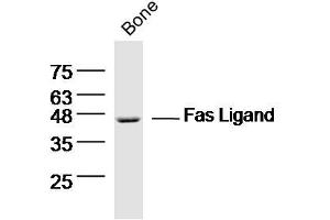 Image no. 6 for anti-Fas Ligand (TNF Superfamily, Member 6) (FASL) (AA 196-281) antibody (ABIN726410)