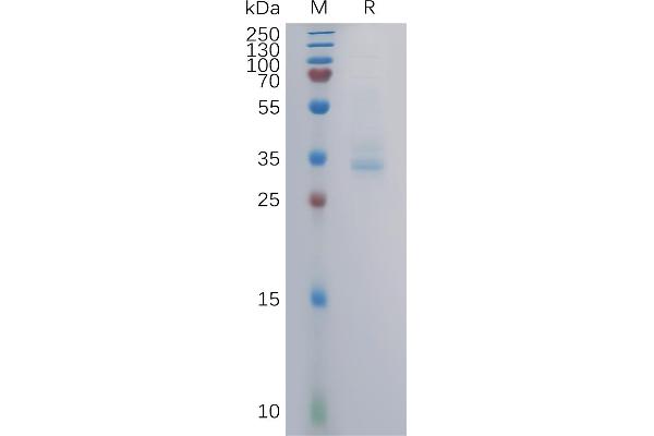 GPRC5B Protein (AA 33-56) (mFc Tag)