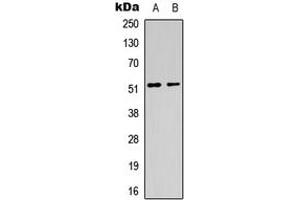 Western blot analysis of CHRM1 expression in HeLa (A), mouse brain (B) whole cell lysates. (CHRM1 Antikörper  (Center))