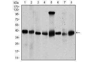 Image no. 2 for anti-Protein Phosphatase, Mg2+/Mn2+ Dependent, 1A (PPM1A) antibody (ABIN1491178) (PPM1A Antikörper)