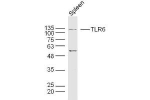 Western Blotting (WB) image for anti-Toll-Like Receptor 6 (TLR6) (AA 301-400) antibody (ABIN749573)