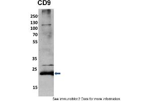 Sample Type: mouse fibroblast lusate (10ug)Primary Dilution: 1:2000 (1% BSA)Secondary Dilution: 1:2000 (5% milk)Image Submitted By: Anonymous researcher . (CD9 Antikörper  (N-Term))