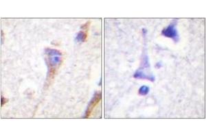 Immunohistochemistry (IHC) image for anti-Protein Kinase D1 (PRKD1) (AA 429-478) antibody (ABIN2888772) (PKC mu Antikörper  (AA 429-478))