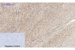 Immunohistochemical analysis of paraffin-embedded human uterus tissue. (Cyclin A Antikörper  (AA 190-270))