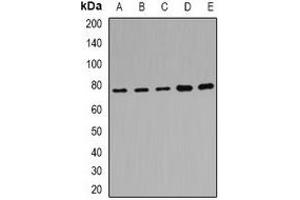 Western blot analysis of POR expression in Hela (A), MCF7 (B), mouse liver (C), mouse kidney (D), rat brain (E) whole cell lysates. (POR Antikörper)