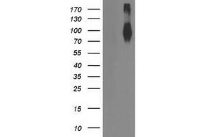 Western Blotting (WB) image for anti-Fibroblast Growth Factor Receptor 2 (FGFR2) antibody (ABIN1498250) (FGFR2 Antikörper)